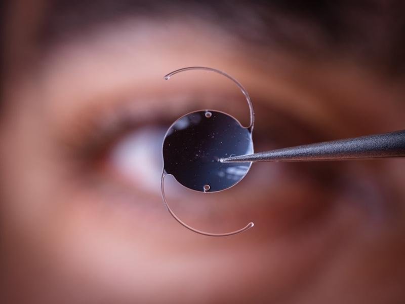 Premium foldable intraocular lens used in cataract surgery