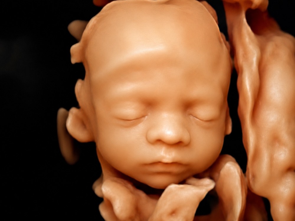 4D pregnancy ultrasound live moving image of a baby in the womb