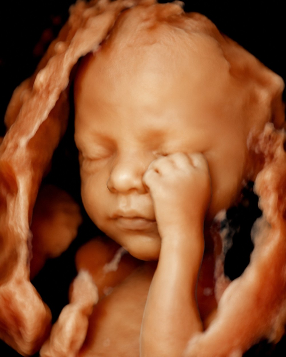 5D HDlive photorealistic pregnancy ultrasound portrait of a baby
