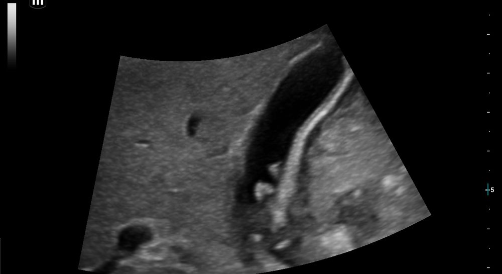 Whole-body high-resolution ultrasound of the abdomen and soft tissues